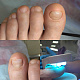 Курс «Коррекция ногтей (полный курс): пластины, скобы, протезирование», 6 дней